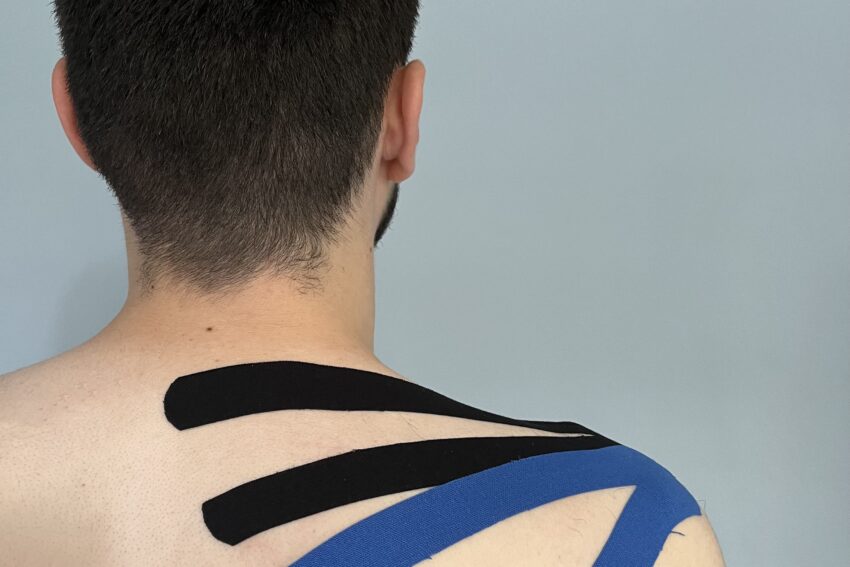 Kinesiotaping